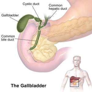 gallbladder removal surgery